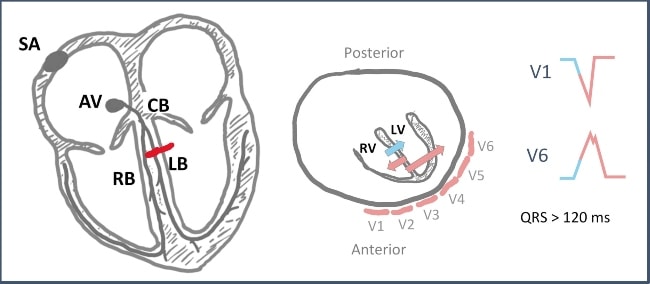 77-Year-Old Man Presents with Dyspnea