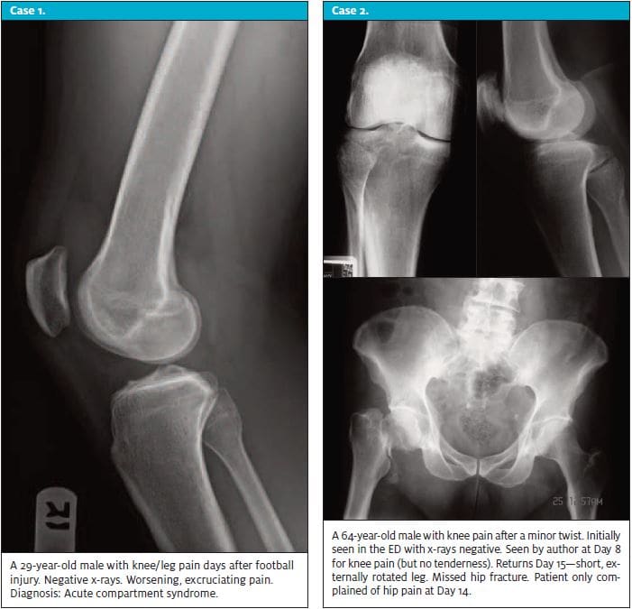 When x-rays lie - Case 1 & 2