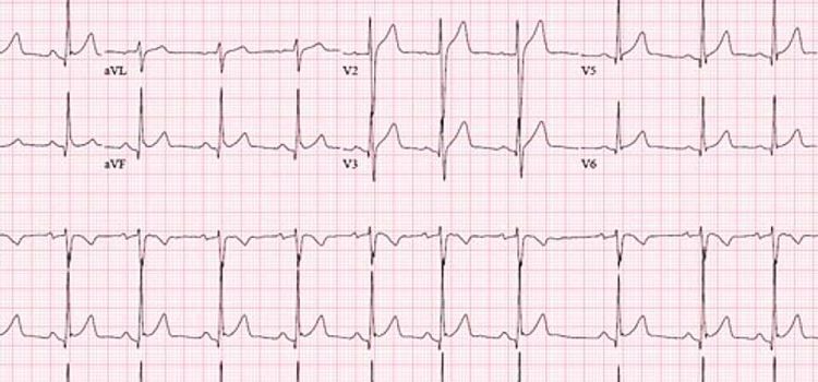 A 21-Year-Old Male Presents with Altered Mental Status After a Vehicle Accident