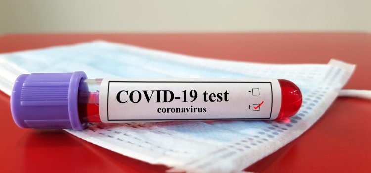 ‘Test to Treat’ COVID-19 Plans May Bear Some Clarification When It Comes to Urgent Care