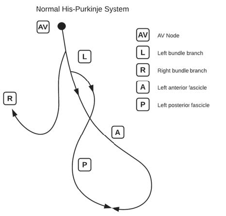 bifascicular block - Normal His-Purkinje System