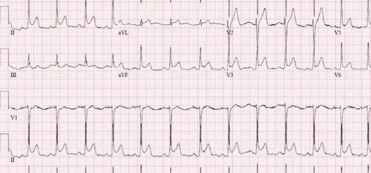 A 37-Year-Old Female Presents with Sharp, Pleuritic Chest Pain