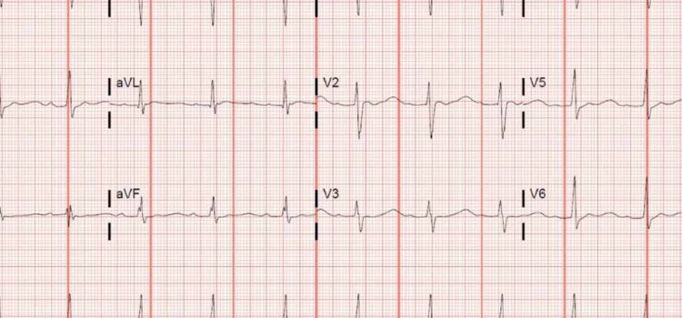 A 31-Year-Old Male Complaining of Weakness