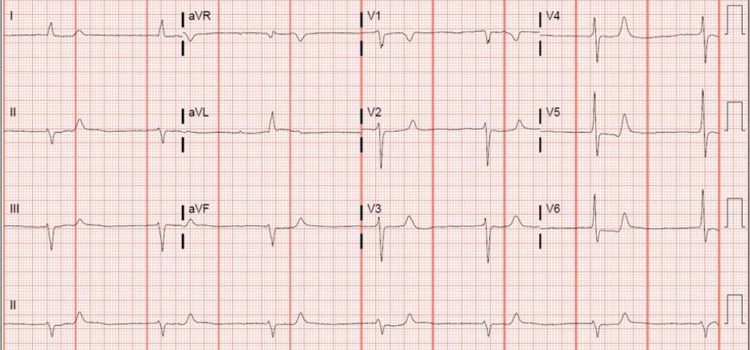 A 50-Year-Old Male Presents with Right Foot Pain