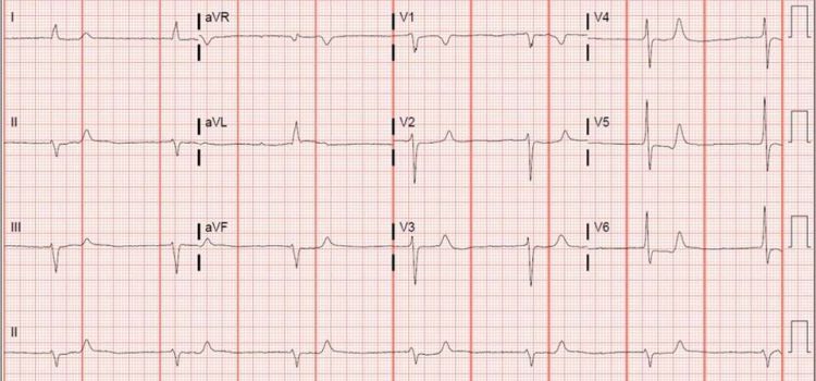 A 50-Year-Old Male Presents with Right Foot Pain