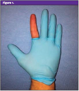 Finger Tourniquet - the glove technique