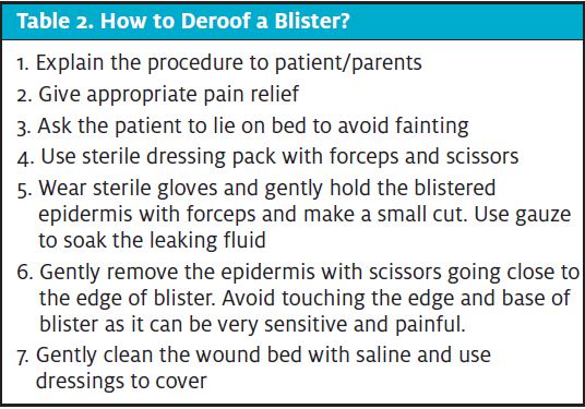 Table 2. How to debroof a burn blister in urgent care, Management of Burn Blisters