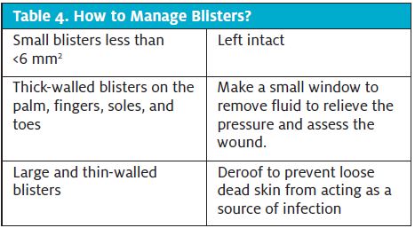 Table 4. How to manage burn blisters in urgent care, Management of Burn Blisters