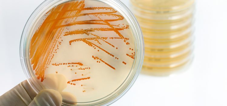 Better Antibiotic Stewardship May Start with Improving Diagnostic Stewardship