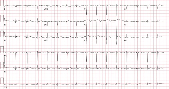 Male with Shortness of Breath