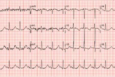 A 20-Year-Old Female with Weakness, Vomiting, and a History of Alcohol Abuse