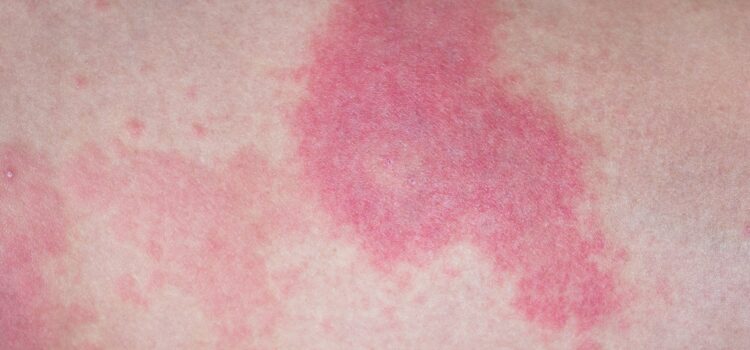 Not so Confident When It Comes to Derm Presentations? You May Be More Capable Than You Think