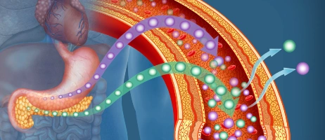 Diabetes Screening in UC: If we don't catch it, who will?