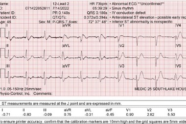 46-Year-Old Male With Severe, Worsening Chest Pain