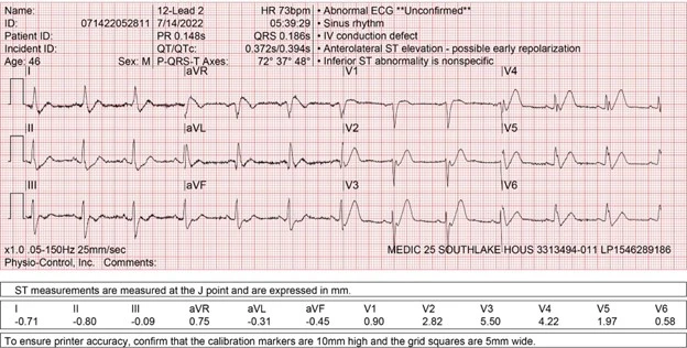 Male With Severe, Worsening Chest Pain