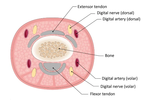 Figure 4. Diagram, Image Provided Courtesy of EB Medicine 