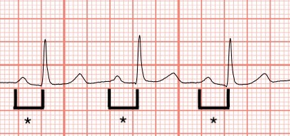 Facial Pain and History of Hypertension Diagnosis Outlined