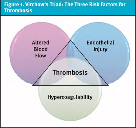 Delayed Pulmonary Embolism Diagnosis - Virchow's Triad