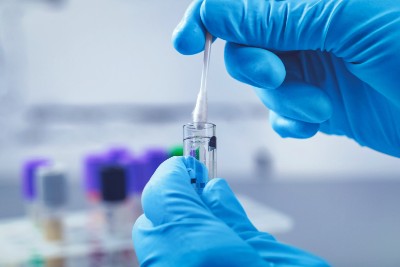 Diagnostic Lab Test Utilization in Urgent Care Diagnostic Lab Test Utilization in Urgent Care