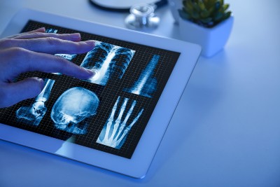 AI Tools May Take Some Tasks Off The Radiologist’s Hands AI Tools May Take Some Tasks Off The Radiologist’s Hands