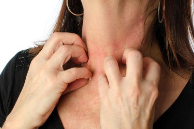 OTC Allergy Drugs Can Cause Severe Pruritus With Sudden Discontinuation OTC Allergy Drugs Can Cause Severe Pruritus With Sudden Discontinuation