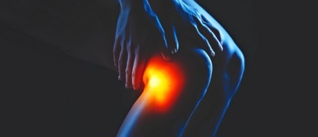 Ruptured Baker Cyst