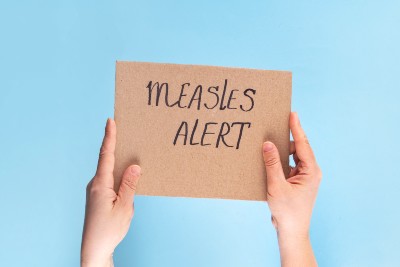 Some Measles Cases Are Showing Up In Vaccinated Patients Some Measles Cases Are Showing Up In Vaccinated PatientsÂ