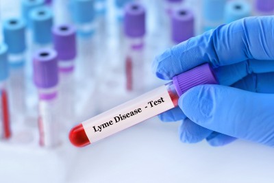 New Lyme Disease Blood Test Promises High Sensitivity, Specificity