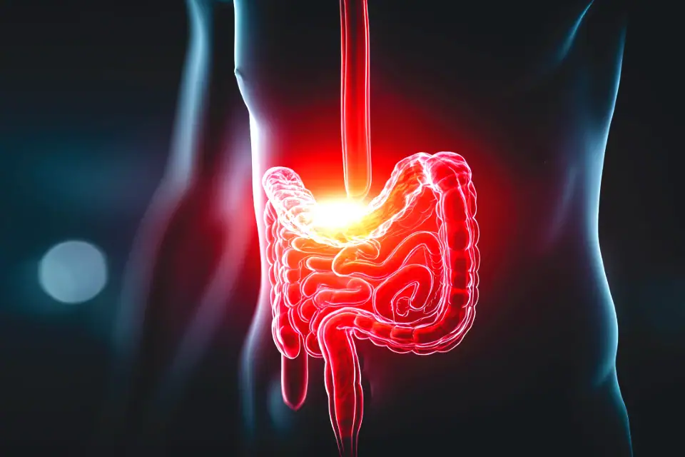 Viral Gastroenteritis With Bowel Obstruction: A Case Report