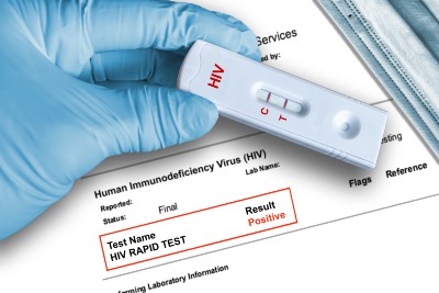 Urgent Care Increases HIV Testing