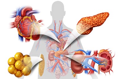 Forthcoming AHA Guidelines Will Address Emerging Approach To CKM Syndrome Forthcoming AHA Guidelines Will Address Emerging Approach To CKM Syndrome