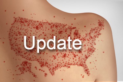 Measles Surge Isn’t Behind Us Just Yet Measles Surge Isn’t Behind Us Just Yet