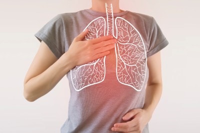 Pneumonia Patients Rarely Tested For Possible Fungal Disease Pneumonia Patients Rarely Tested For Possible Fungal Disease