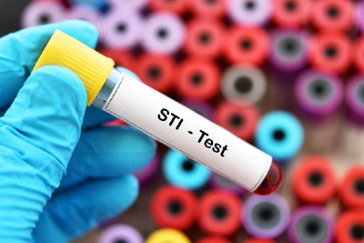 Testing And Treating STIs Leads To Progress