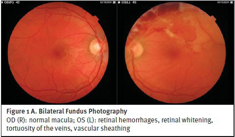 Behçet Disease in Urgent Care