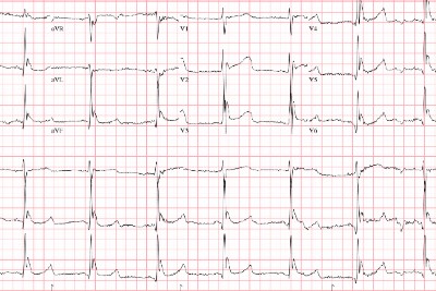 42-Year-Old With Altered Mental Status