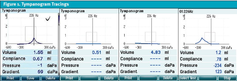 Tympanometry as a Diagnostic Tool in Urgent Care