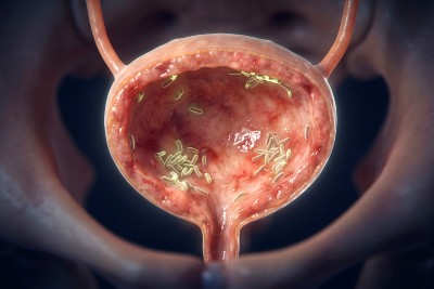 New Oral Drug For Complicated UTI