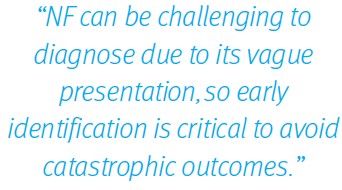 Necrotizing Fasciitis Quote on Challenge to Diagnose