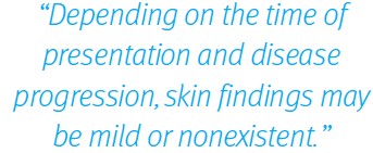 Necrotizing Fasciitis presentation quote