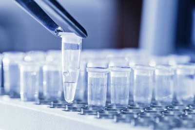 Pathogen Findings and UTIs