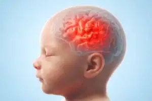 Infant with Neuroblastoma Presenting as Eye Bruising