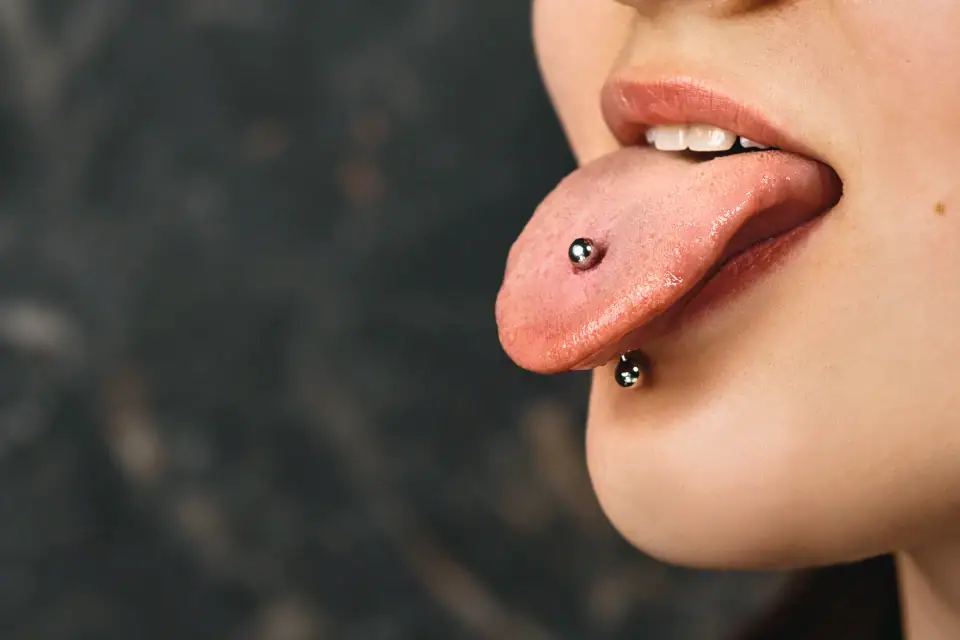 Accidental Tongue Ring Ingestion in Urgent Care