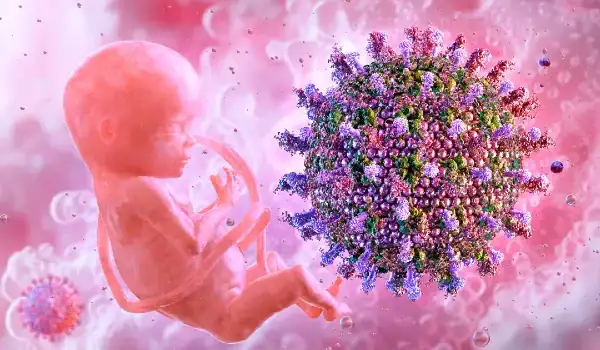 What Is Congenital Measles? What Is Congenital Measles?