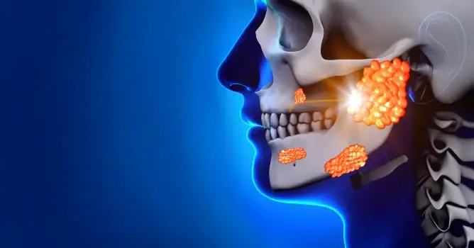 San Diego University Offers Clinic After Mumps Outbreak San Diego University Offers Clinic After Mumps Outbreak