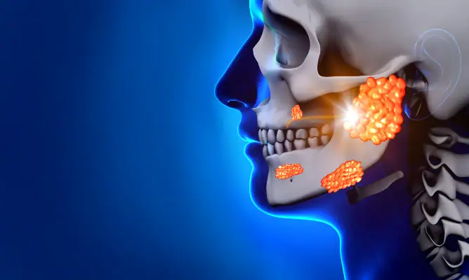 Clinic After Mumps Outbreak