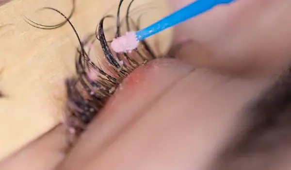 Eyelash Extensions Often Lead To Mite-Related Irritation Eyelash Extensions Often Lead To Mite-Related Irritation