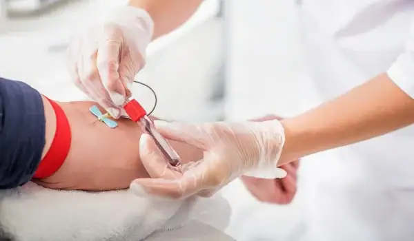 Fasting Before Lab Testing Should Be More Nuanced: Study Fasting Before Lab Testing Should Be More Nuanced: Study