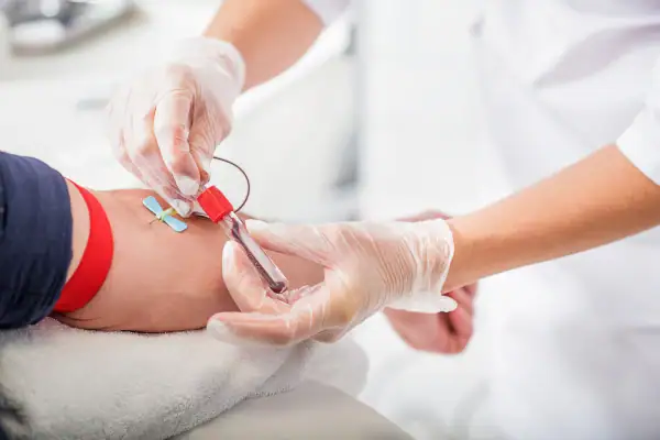 Fasting Lab Test Study
