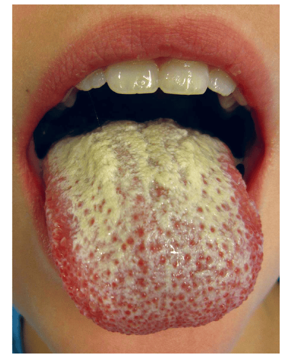 Textbook of Urgent Care Medicine, Chapter 14, Dental Injuries and Pain ...